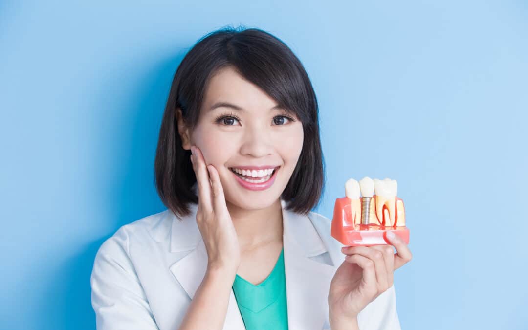 Top 6 Psychological Benefits Of Dental Implants