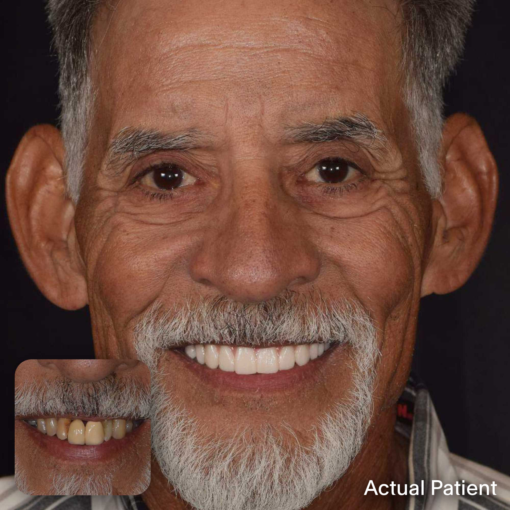 Andrew, Doctors Implants Patient