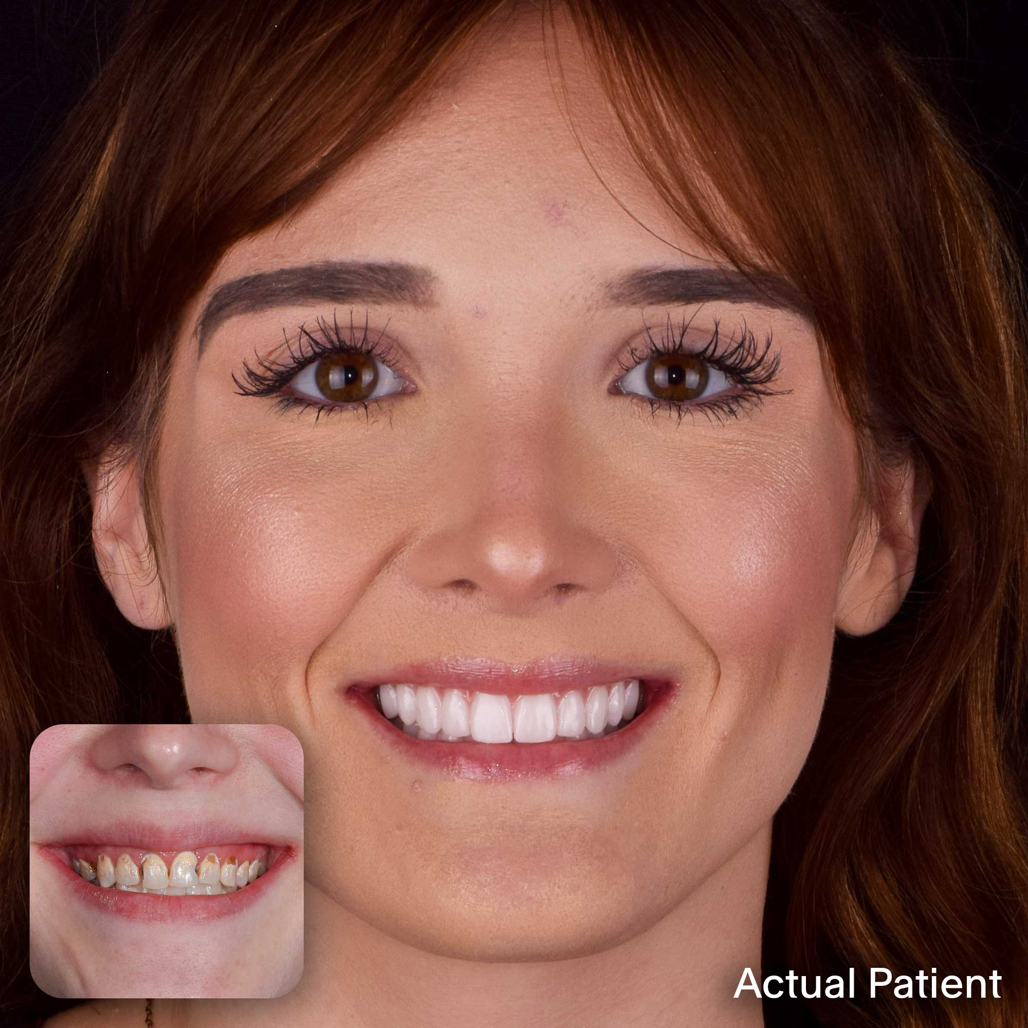 Darien, Doctors Implants Patient