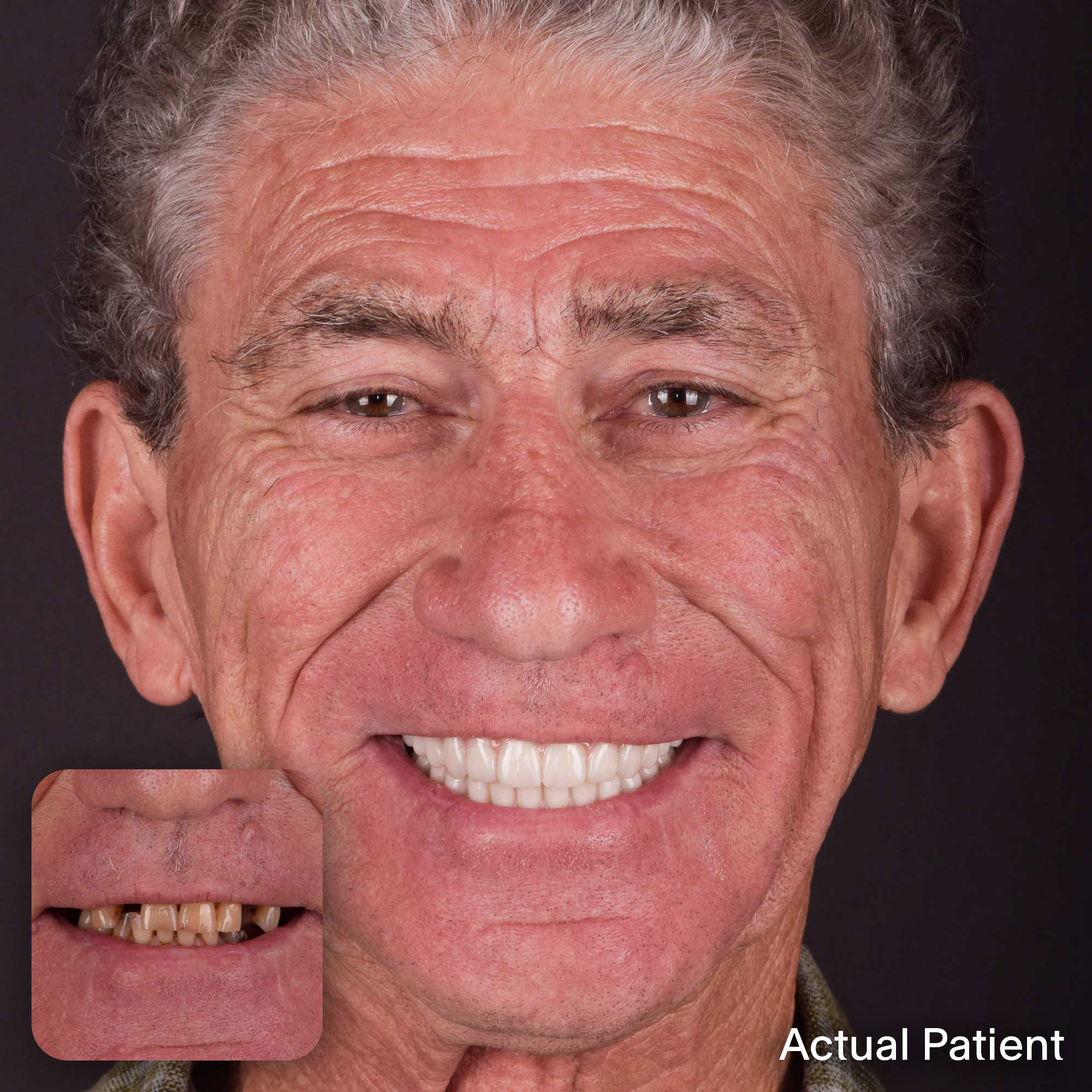 Doug, Doctors Implants Patient