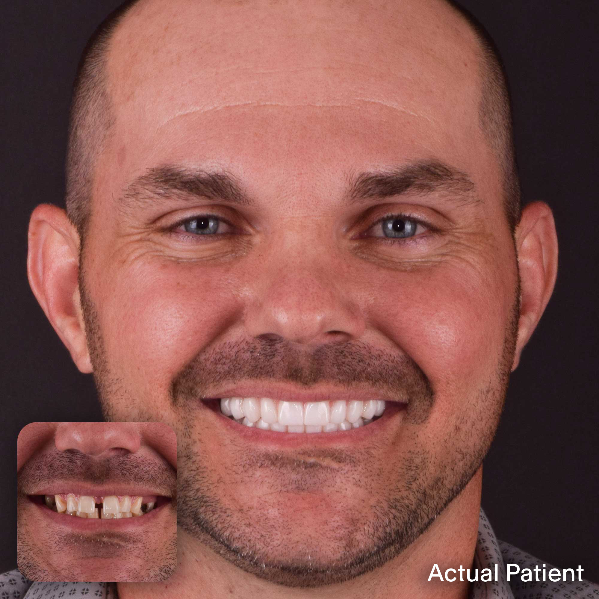 Justin, Doctors Implants Patient