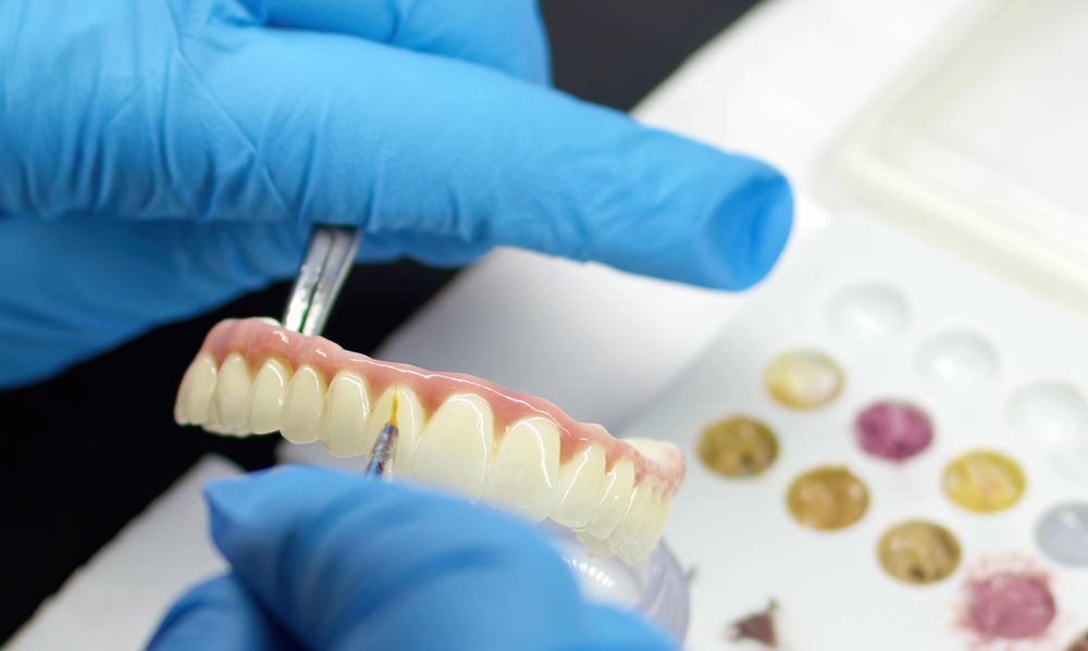 dental implants