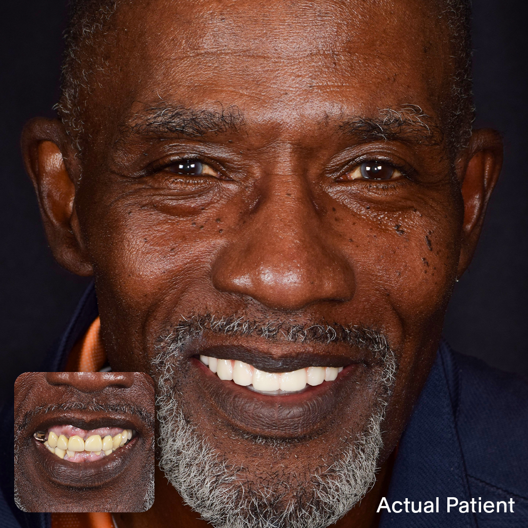 Rudy, Doctors Implants Patient